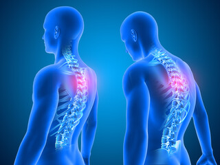 southwest-austin-massage-laser-therapy